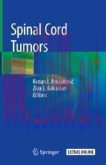 [PDF]Spinal Cord Tumors