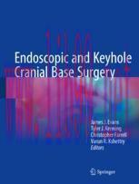 [PDF]Endoscopic and Keyhole Cranial Base Surgery