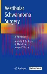 [PDF]Vestibular Schwannoma Surgery: A Video Guide
