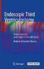 [PDF]Endoscopic Third Ventriculostomy: Classic Concepts and a State-of-the-Art Guide