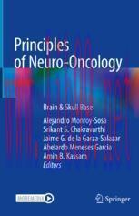 [PDF]Principles of Neuro-Oncology: Brain & Skull Base