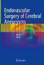 [PDF]Endovascular Surgery of Cerebral Aneurysms