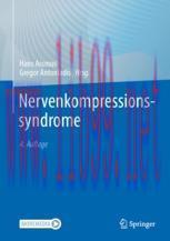 [PDF]Nervenkompressionssyndrome