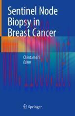 [PDF]Sentinel Node Biopsy in Breast Cancer
