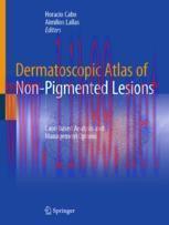 [PDF]Dermatoscopic Atlas of Non-Pigmented Lesions: Case-based Analysis and Management Options