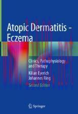 [PDF]Atopic Dermatitis - Eczema: Clinics, Pathophysiology and Therapy