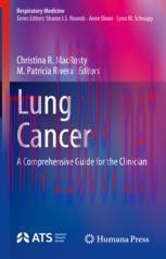 [PDF]Lung Cancer: A Comprehensive Guide for the Clinician