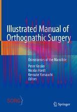 [PDF]Illustrated Manual of Orthognathic Surgery: Osteotomies of the Mandible