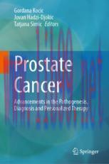 [PDF]Prostate Cancer: Advancements in the Pathogenesis, Diagnosis and Personalized Therapy