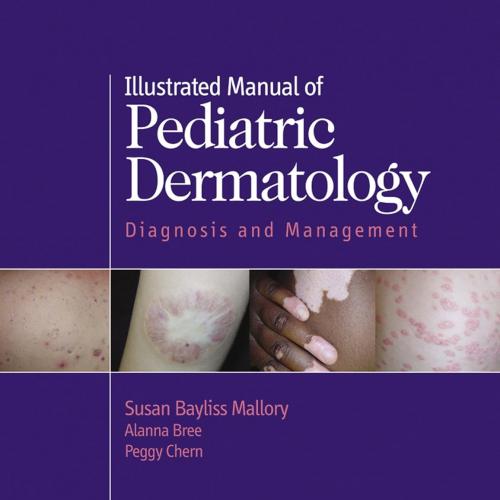 Illustrated Manual of Pediatric Dermatology: Diagnosis and Management 1st Edition