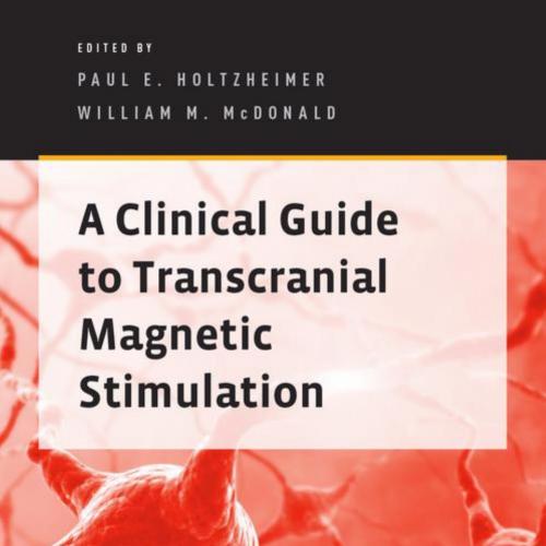 Clinical Guide to Transcranial Magnetic Stimulation, A