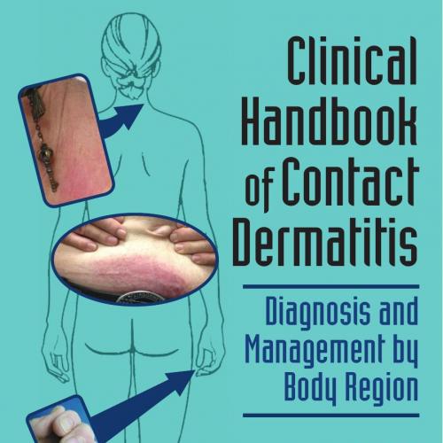 Clinical Handbook of Contact Dermatitis - Diagnosis and Management by Body Region, 1E (2015) [PDF] [UnitedVRG]