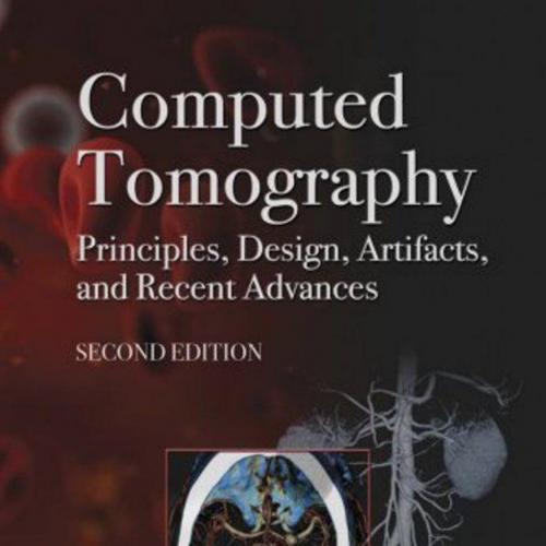 Computed Tomography Principles, Design, Artifacts, and Recent Advances, 2nd Edition