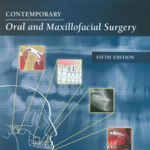 Contemporary Oral and Maxillofacial Surgery, 5e - James R. Hupp, Edward Ellis III, Myron R. Tucker