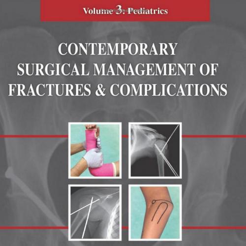 Contemporary Surgical Management of Fractures and Complications Pediatrics (Volume 3)