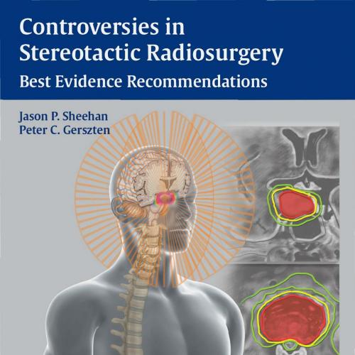 Controversies in Stereotactic Radiosurgery-Best Evidence Recommendations