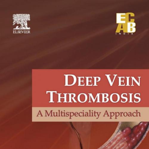 Deep Vein Thrombosis A Multispeciality Approach