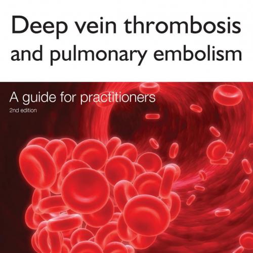 Deep Vein Thrombosis and Pulmonary Embolism A Guide for Practitioners 2nd Edition