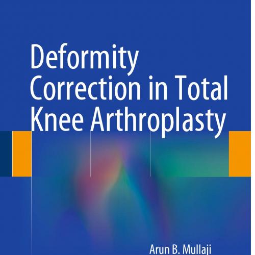 Deformity Correction in Total Knee Arthroplasty