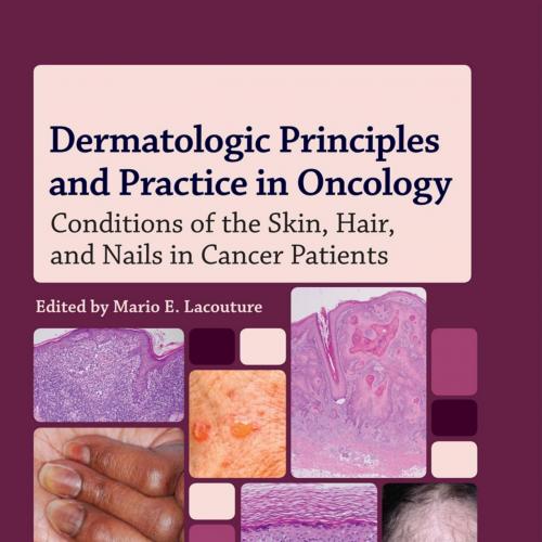 Dermatologic Principles and Practice in Oncology Conditions of the Skin, Hair, and Nails in Cancer Patients