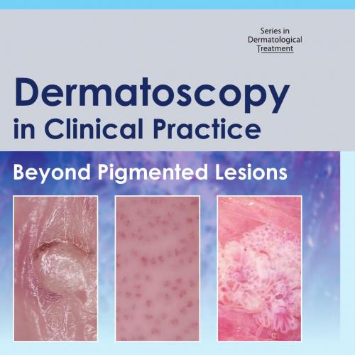 Dermatoscopy in Clinical Practice_ Beyond Pigmented Lesions - Giuseppe Micali, Francesco Lacarrubba