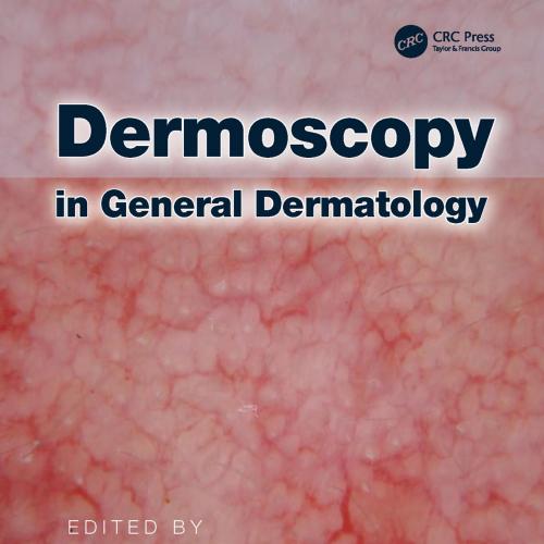 Dermoscopy in General Dermatology - Wei Zhi