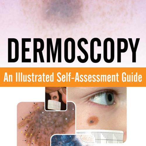 Dermoscopy_ An Illustrated Self-Assessment Guide - Robert Johr, Wilhelm Stolz