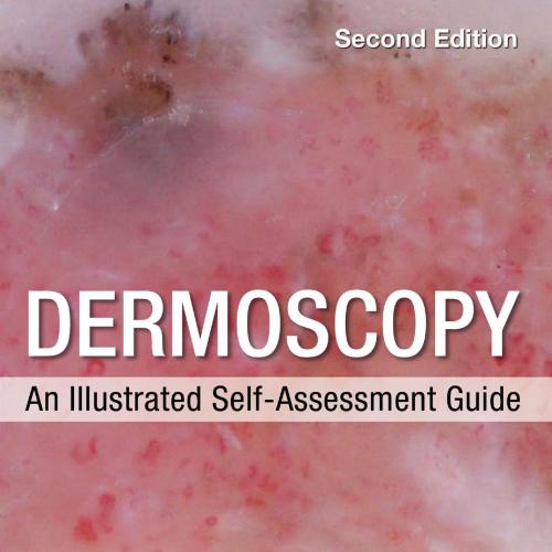 Dermoscopy_ An Illustrated Self-Assessment Guide 2nd - Johr, Robert, Stolz, Wilhelm
