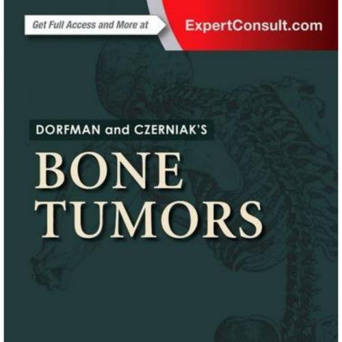 Dorfman and Czerniak''s Bone Tumors, 2nd Edition