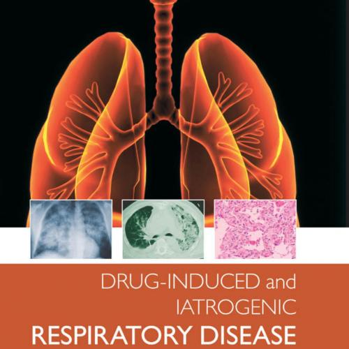 Drug-induced and Iatrogenic Respiratory Disease - Camus, Philippe.,Rosenow, Edward C_