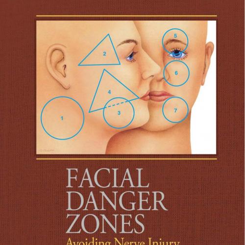 Facial Danger Zones Avoiding Nerve Injury in Facial Plastic Surgery 2nd Edition