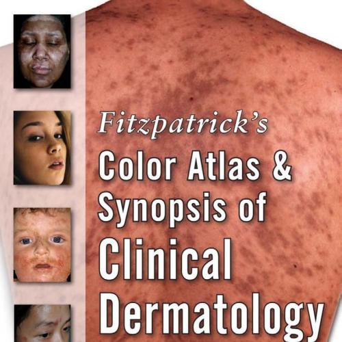 Fitzpatrick's Color Atlas and Synopsis of Clinical Dermatology 6th Edition