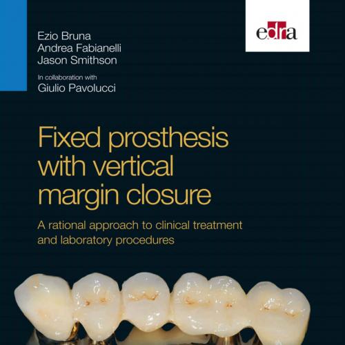 Fixed prosthesis with vertical margin closure A rational approament and laboratory procedures - Ezio Bruna & Andrea Fabianelli