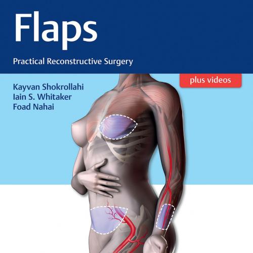 Flaps Practical Reconstructive Surgery