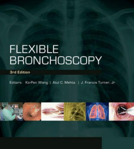 Flexible Bronchoscopy,3rd Edition