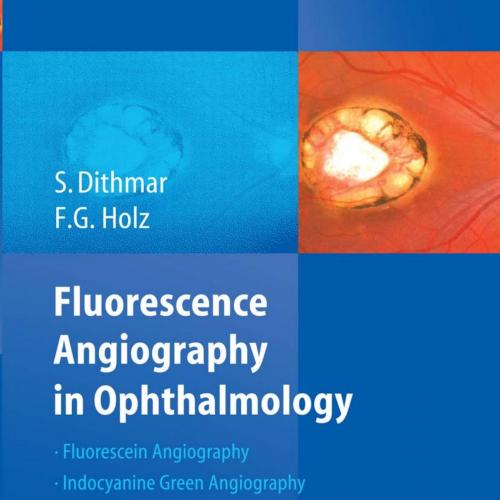 Fluorescence Angiography In Ophthalmology - Wei Zhi