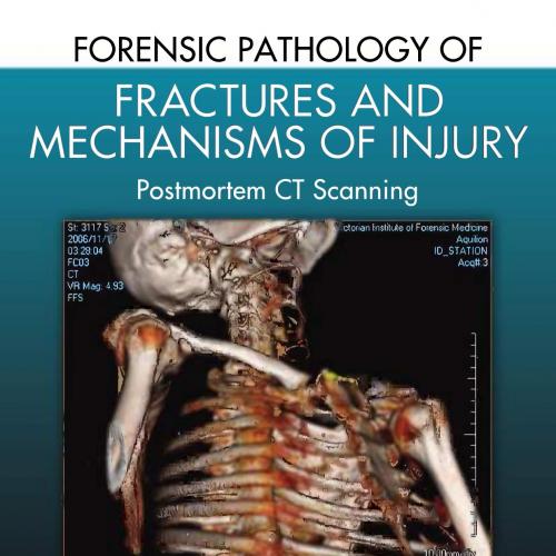 Forensic Pathology of Fractures and Mechanisms of Injury-Postmortem CT Scanning