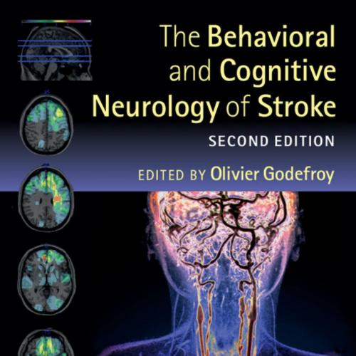 Behavioral and Cognitive Neurology of Stroke, The
