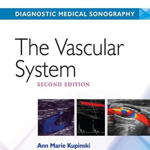 Vascular System (Diagnostic Medical Sonography Series) 2nd Edition, The - Ann Marie Kupinski