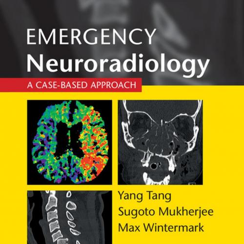 Emergency Neuroradiology A Case-Based Approach - Mukherjee, Sugoto, Wintermark, Max, Tang, Yang
