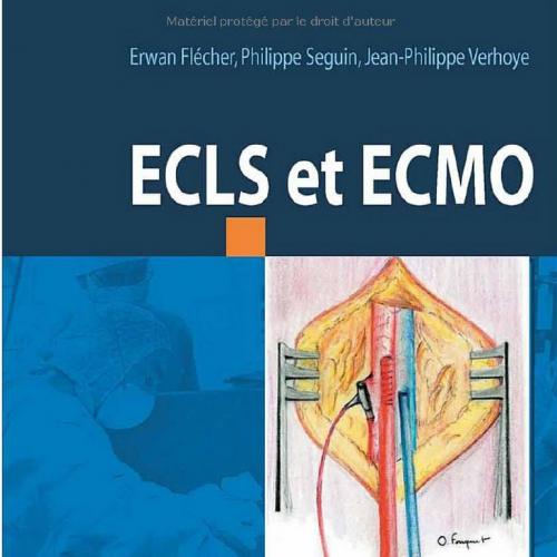ECLS et ECMO guide pratique
