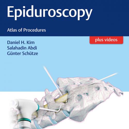 Epiduroscopy Atlas of Procedures - 1st edition