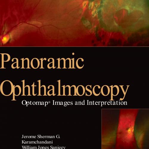 Panoramic Ophthalmoscopy Optomap Images and Interpretation