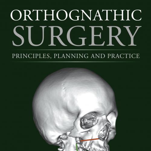 Orthognathic Surgery Principles, Planning and Practice