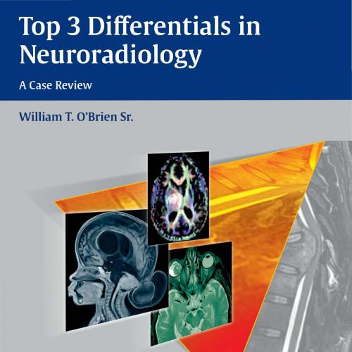 Top 3 Differentials in Neuroradiology - giorgiana