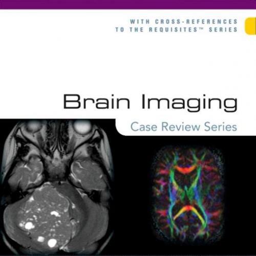Brain Imaging_ Case Review Series, Second Edition