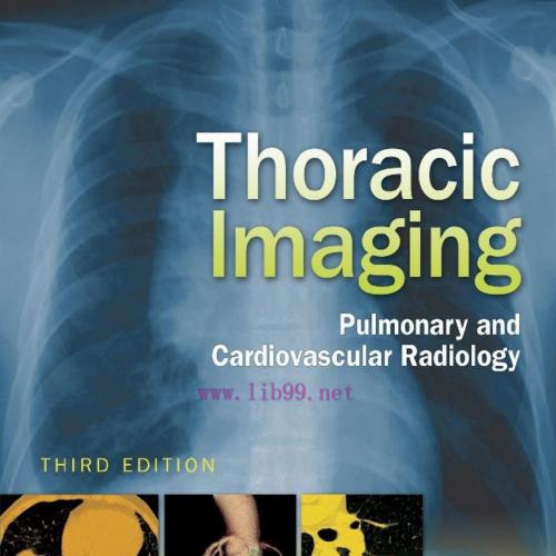 Thoracic Imaging Pulmonary and Cardiovascular Radiology