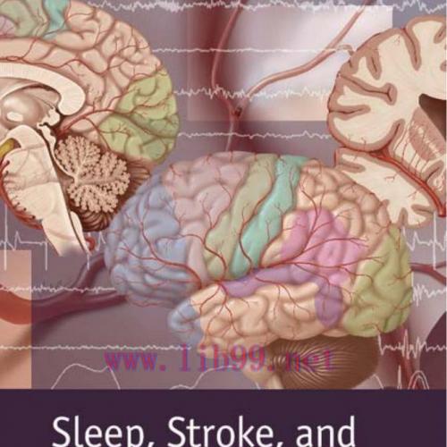 Sleep, Stroke, and Cardiovascular Disease