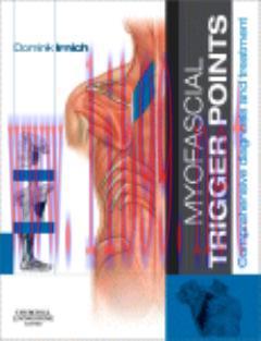 Myofascial Trigger Points-Comprehensive diagnosis and treatment