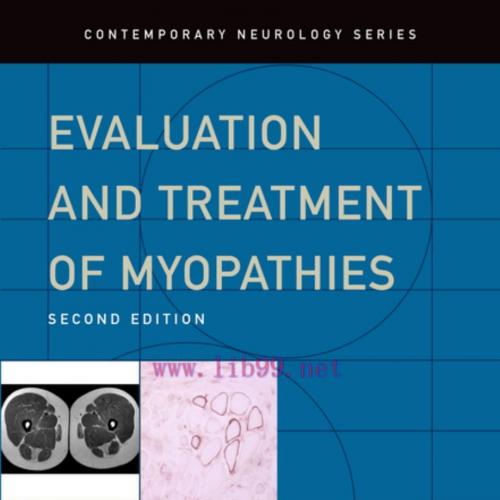 Evaluation and Treatment of Myopathies, 2nd Edition